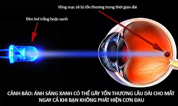 1> Ánh Sáng Xanh Là Gì 5 anh sang canh bao